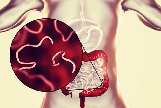 Jakie leki na pasożyty u człowieka są najskuteczniejsze i bezpieczne?