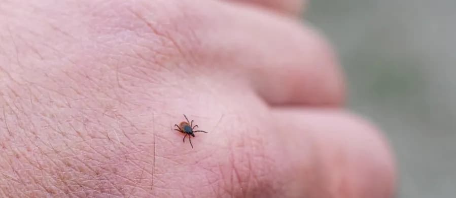 Do jakiego lekarza z kleszczem? Objawy, które mogą zaniepokoić