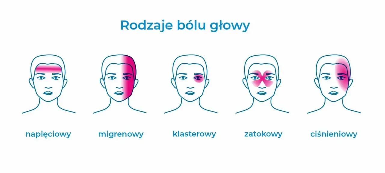 Objawy bólu głowy: jak rozpoznać i zrozumieć swoje dolegliwości