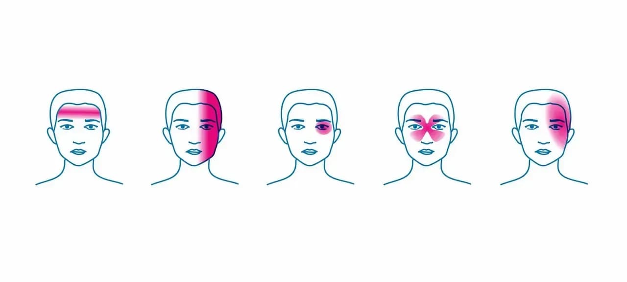 Napięciowe bóle głowy objawy: jak je rozpoznać i złagodzić ból