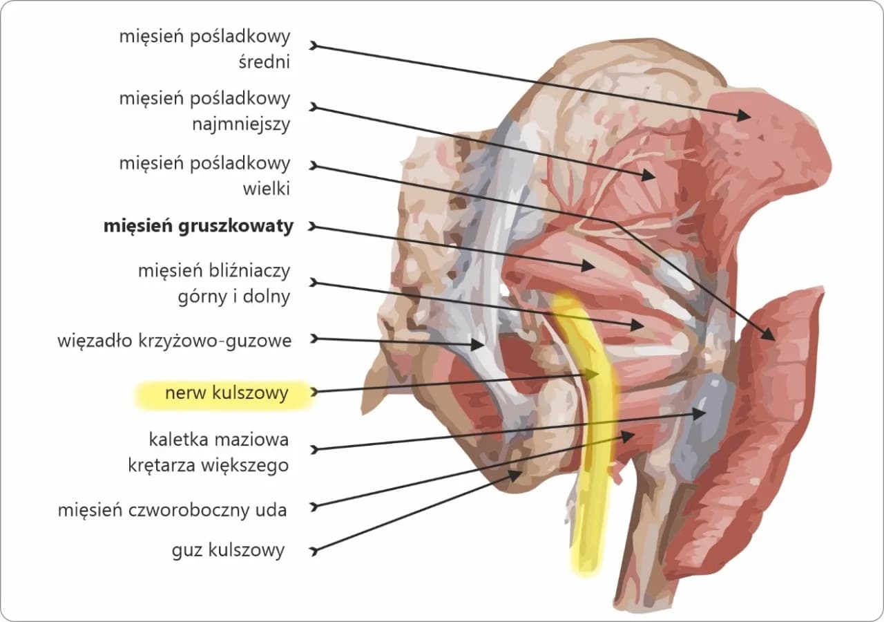 Jak złagodzić ból pośladków po zastrzykach – skuteczne sposoby i porady