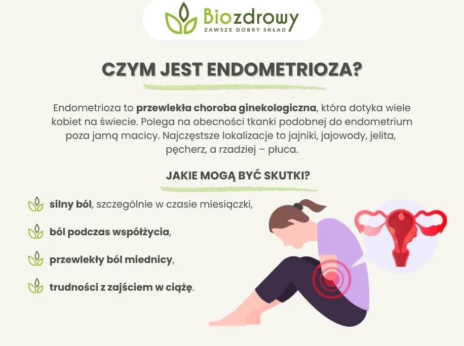 Endometrioza objawy forum: co naprawdę musisz wiedzieć o bólu